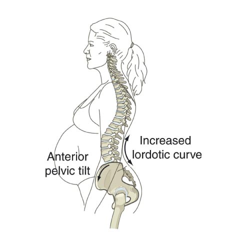 pregnant, spine, back, pain